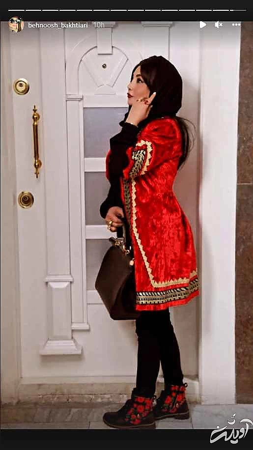 این خانم بازیگر رکورددار جراحی زیبایی ایرانی ! + تصاویری افشاگر !